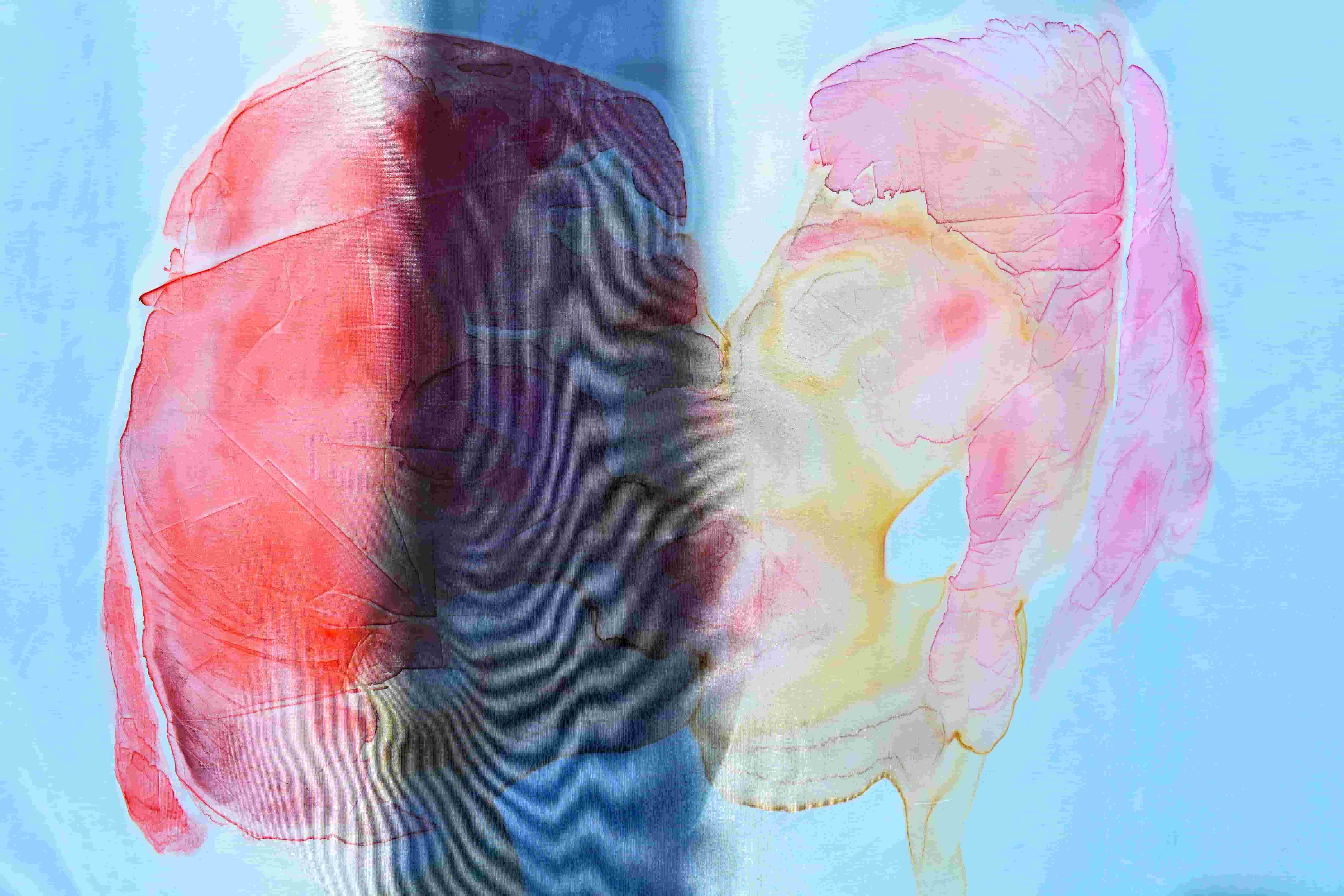 two abstracts faces kiss, formed by intricate layers of watercolour pigment on satin fabric